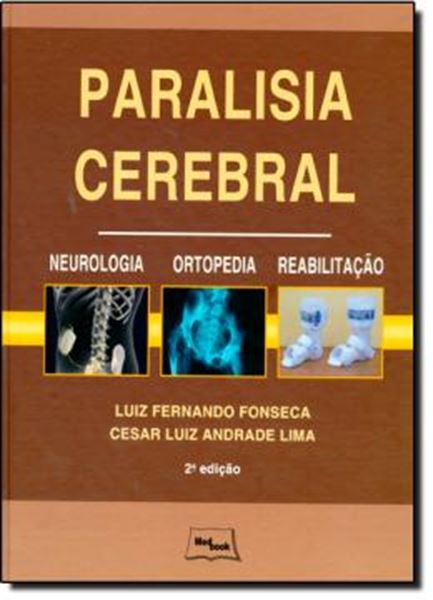 Picture of PARALISIA CEREBRAL - 2ª EDICAO