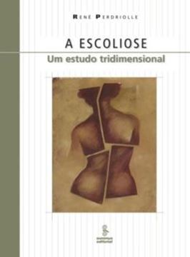 Imagem de ESCOLIOSE, A