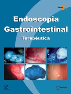Imagem de ENDOSCOPIA GASTROINTESTINAL  TERAPEUTICA