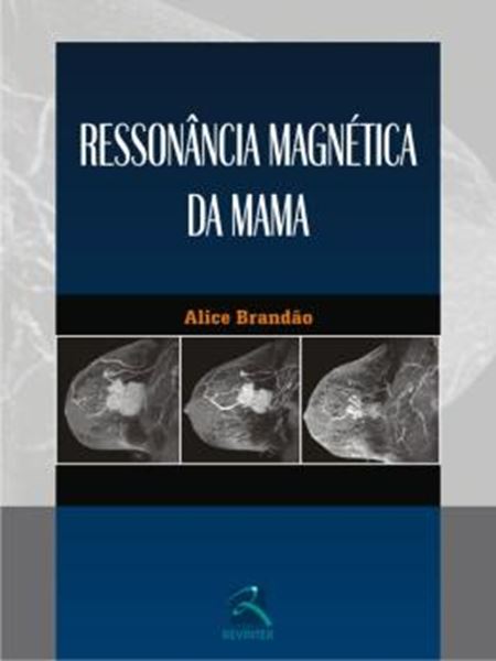 Picture of RESSONANCIA MAGNETICA DA MAMA