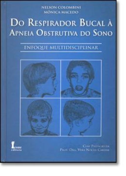 Picture of DO RESPIRADOR BUCAL A APNEIA OBSTRUTIVA DO SONO