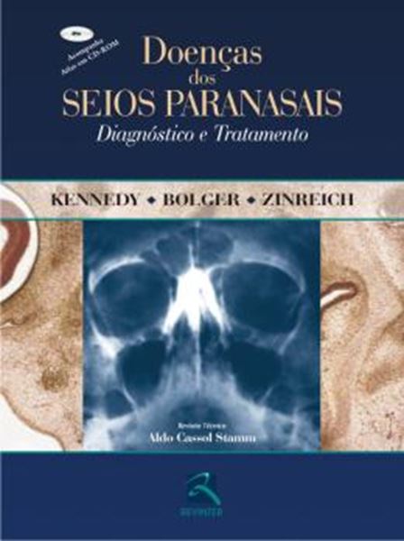 Picture of DOENCAS DOS SEIOS PARANASAIS - DIAGNOSTICO E TRATAMENTO