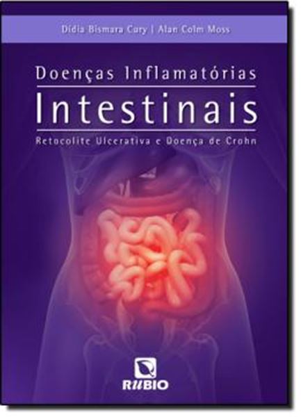 Picture of DOENCAS INFLAMATORIAS INTESTINAIS