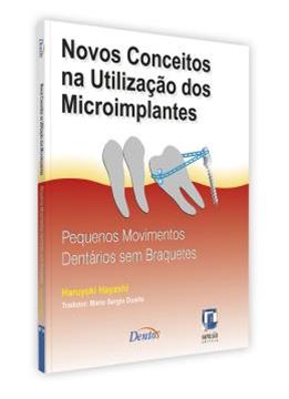 Imagem de NOVOS CONCEITOS NA UTILIZACAO DOS MICROIMPLANTES