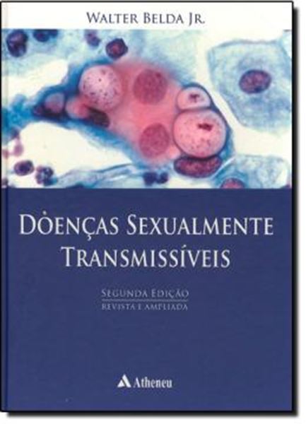 Picture of DOENCAS SEXUALMENTE TRANSMISSIVEIS - 2ª EDICAO