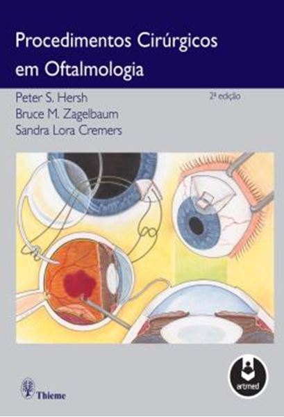 Picture of PROCEDIMENTOS CIRURGICOS EM OFTALMOLOGIA