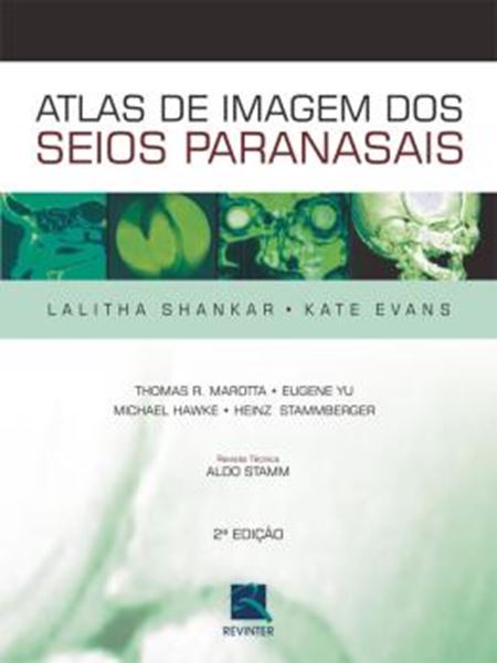 Picture of ATLAS DE IMAGEM DOS SEIOS PARANASAIS - 2ª ED