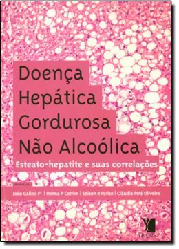 Imagem de DOENCA HEPATICA GORDUROSA NAO ALCOOLICA