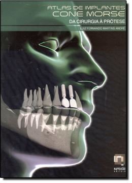 Imagem de ATLAS DE IMPLANTES CONE MORSE - DA CIRURGIA A PROTESE