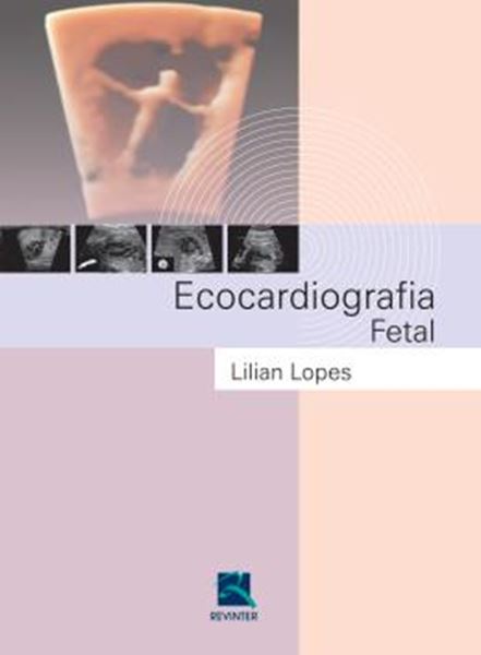 Picture of ECOCARDIOGRAFIA FETAL