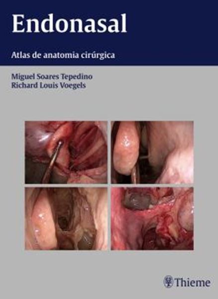 Picture of ENDONASAL - ATLAS DE ANATOMIA CIRURGICA