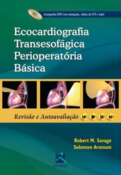 Picture of ECOCARDIOGRAFIA TRANSESOFAGICA PERIOPERATORIA BASICA
