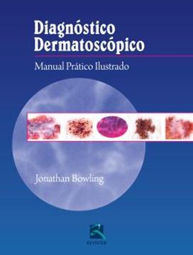 Imagem de DIAGNOSTICO DERMATOSCOPICO - MANUAL PRATICO ILUSTRADO