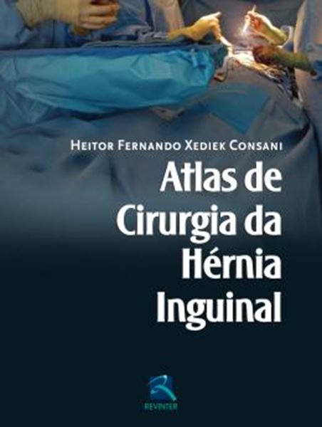 Picture of ATLAS DE CIRURGIA DA HERNIA INGUINAL