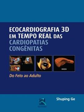 Imagem de ECOCARDIOGRAFIA 3D EM TEMPO REAL DAS CARDIOPATIAS CONGENITAS 