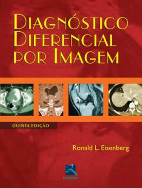 Picture of DIAGNOSTICO DIFERENCIAL POR IMAGEM