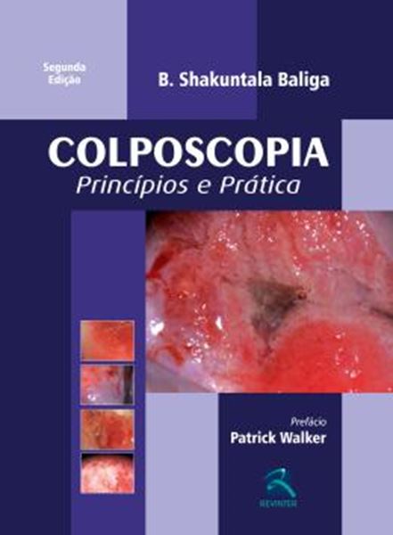 Picture of COLPOSCOPIA - PRINCIPIOS E PRATICA - 2ª ED