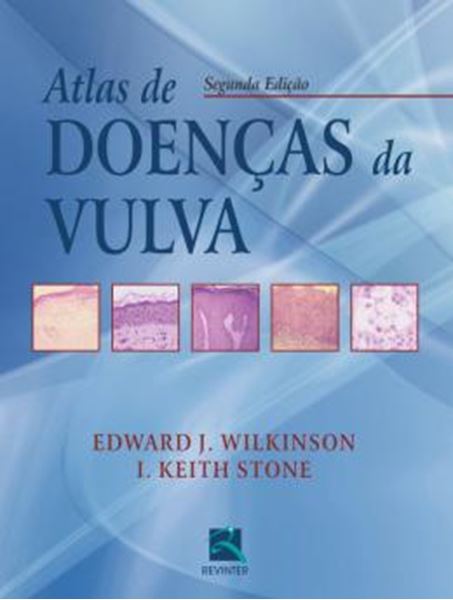 Picture of ATLAS DE DOENCAS DA VULVA - 2ª ED