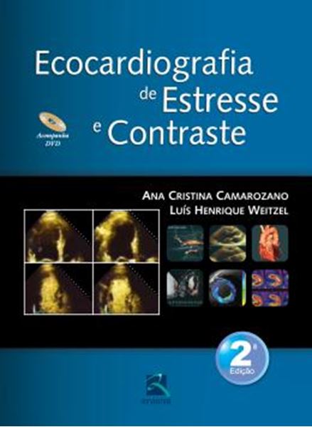 Picture of ECOCARDIOGRAFIA DE ESTRESSE E CONTRASTE - 2ª ED
