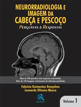 Imagem de NEURORRADIOLOGIA EM CABECA E PESCOCO