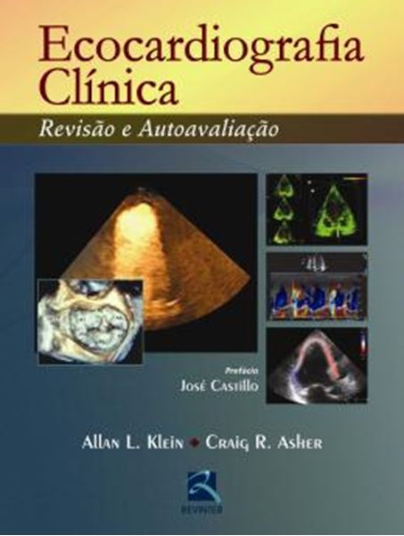 Picture of ECOCARDIOGRAFIA CLINICA REVISAO E AUTOAVALIACAO