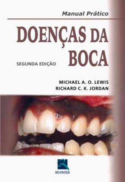 Picture of DOENCAS DA BOCA - 2ª ED