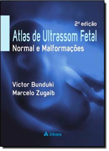 Picture of ATLAS DE ULTRASSOM FETAL - 2ºED