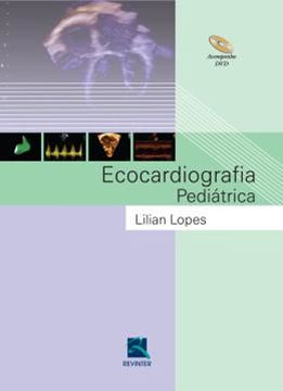 Imagem de ECOCARDIOGRAFIA PEDIATRICA