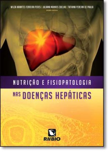 Picture of NUTRICAO E FISIOPATOLOGIA NAS DOENCAS HEPATICAS