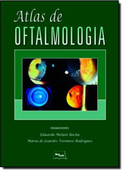 Picture of ATLAS DE OFTALMOLOGIA