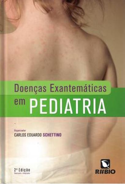 Picture of DOENCAS EXANTEMATICAS EM PEDIATRIA- 2 º ED