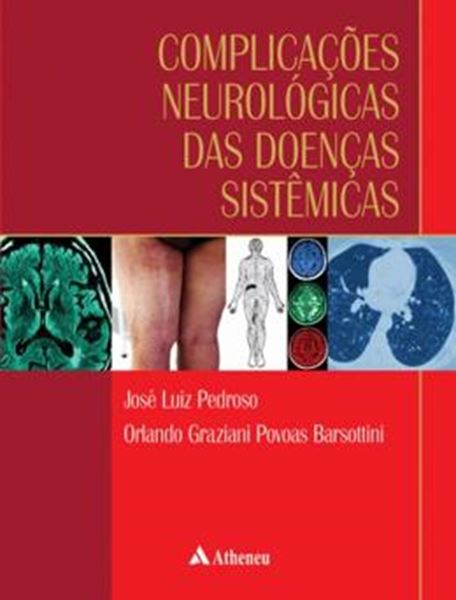 Picture of COMPLICACOES NEUROLOGICAS DAS DOENCAS SISTEMICAS