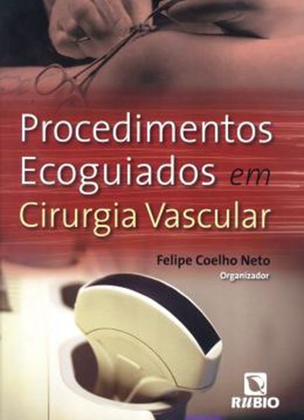 Picture of PROCEDIMENTOS ECOGUIADOS EM CIRURGIA VASCULAR