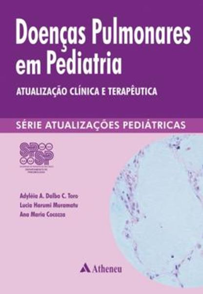 Picture of DOENCAS PULMONARES EM PEDIATRIA - ATUALIZACAO CLINICA E TERAPEUTICA