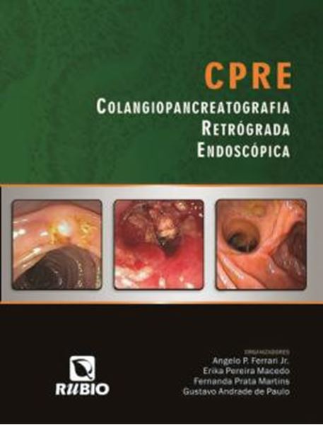 Picture of CPRE - COLANGIOPANCREATOGRAFIA RETROGRADA ENDOSCOPICA
