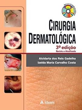 Imagem de CIRURGIA DERMATOLOGICA - 3ª ED