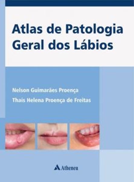 Picture of ATLAS DE PATOLOGIA GERAL DOS LABIOS