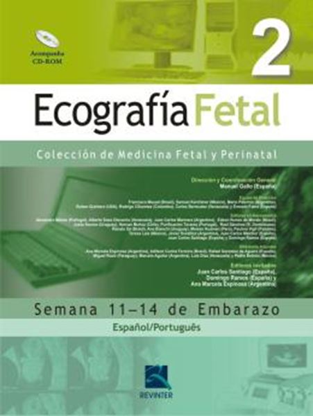 Picture of ECOGRAFIA FETAL VOL. 2