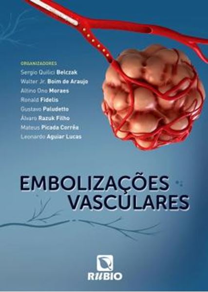 Picture of EMBOLIZACOES VASCULARES
