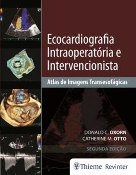 Picture of ECOCARDIOGRAFIA INTRAOPERATORIA E INTERVENCIONISTA - 2ª ED