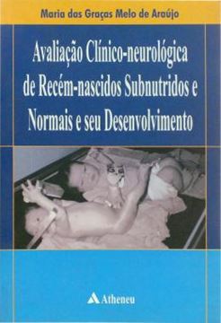 Imagem de AVALIACAO CLINICO-NEUROLOGICA DE RECEM-NASCIDOS SUBNUTRIDOS NORMAIS E SEU DESENVOLVIMENTO