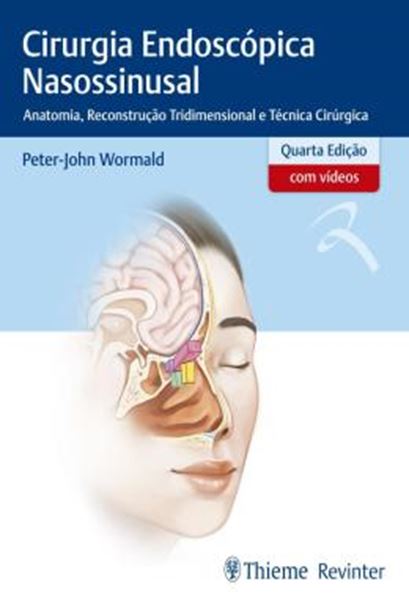 Picture of CIRURGIA ENDOSCOPICA NASOSSINUSAL - ANATOMIA, RECONSTRUCAO TRIDIMENSIONAL E TECNICA CIRURGICA - 4ª ED