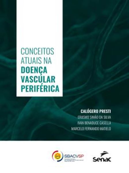Picture of CONCEITOS ATUAIS NA DOENCA VASCULAR PERIFERICA