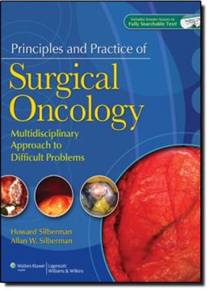 Picture of PRINCIPLES AND PRACTICE OF SURGICAL ONCOLOGY