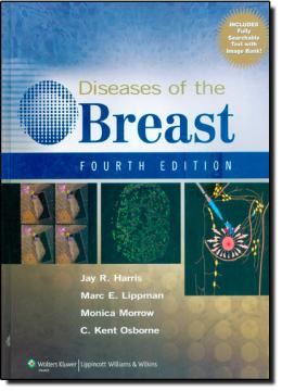Imagem de DISEASES OF THE BREAST - 4TH EDITION