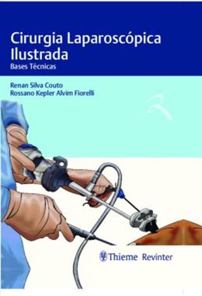 Picture of CIRURGIA LAPAROSCOPICA ILUSTRADA - BASES TECNICAS