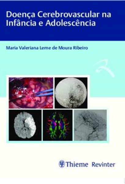 Picture of DOENCA CEREBROVASCULAR NA INFANCIA E ADOLESCENCIA