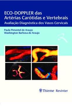 Imagem de ECO-DOPPLER DAS ARTERIAS CAROTIDAS E VERTEBRAIS - AVALIACAO DIAGNOSTICA DOS VASOS CERVICAIS