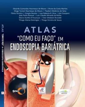 Imagem de ATLAS COMO EU FACO CIRURGIA BARIATRICA