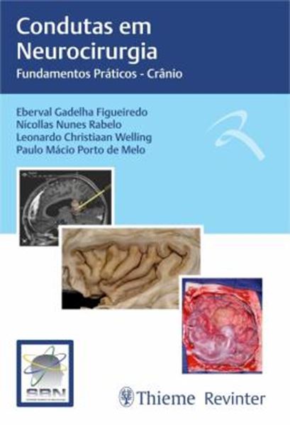 Picture of CONDUTAS EM NEUROCIRURGIA - FUNDAMENTOS PRATICOS - CRANIO